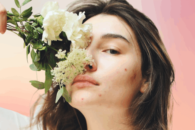 Woman with mild acne holds flowers to nose