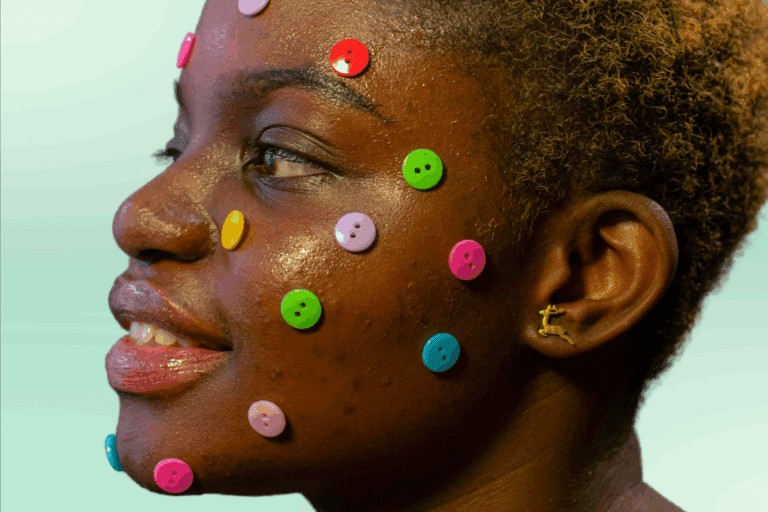 Woman with acne and colorful buttons on her face