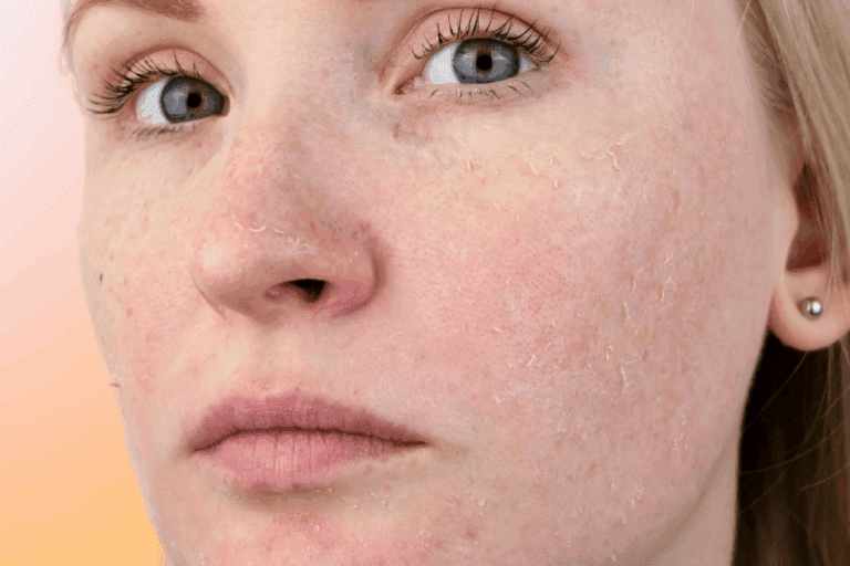 Woman with peeling skin