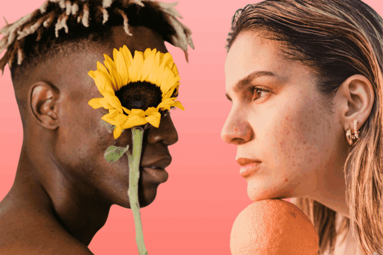 A man and a woman with acne-prone skin