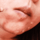 Close up of woman using makeup brush to apply concealer to blemishes on chin
